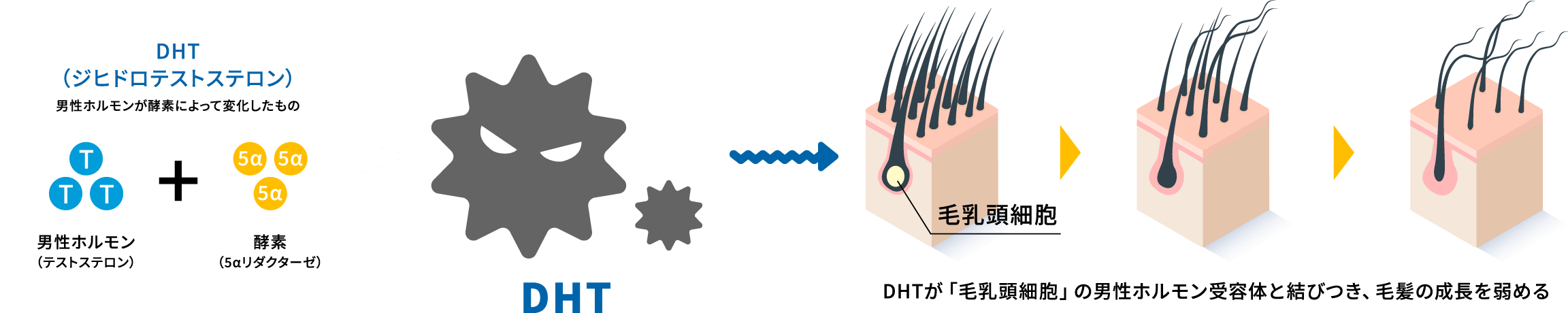 DHTが「毛乳頭細胞」の男性ホルモン受容体と結びつき、毛髪の成長を弱める